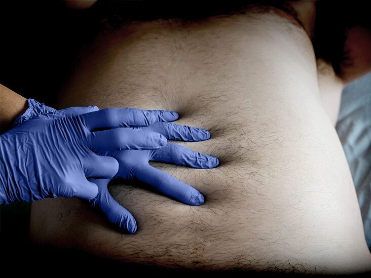 What to know about stage 3 stomach cancer