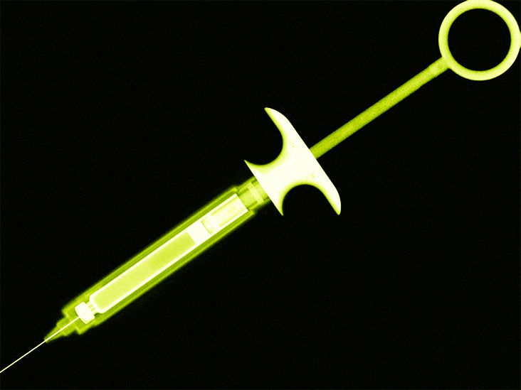 Worse pain after epidural What to know