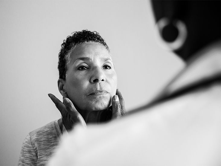 Lupus and scleroderma Connection and differences