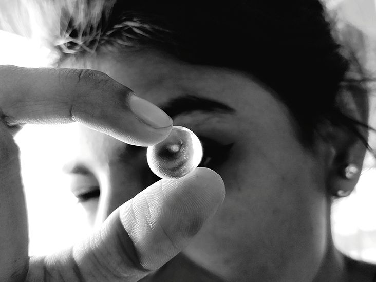 Non agerelated macular degeneration (MD) Causes and treatment