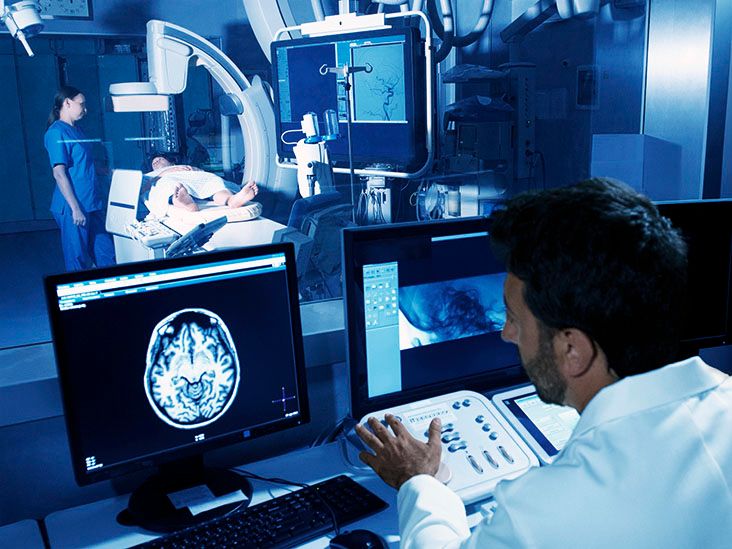 HOW LONG IS A BRAIN ANGIOGRAM visual data 5