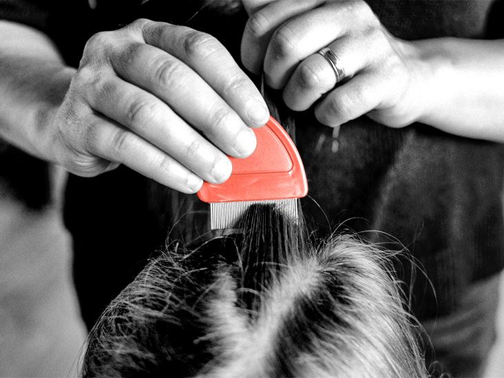 What types of lice medication are available?