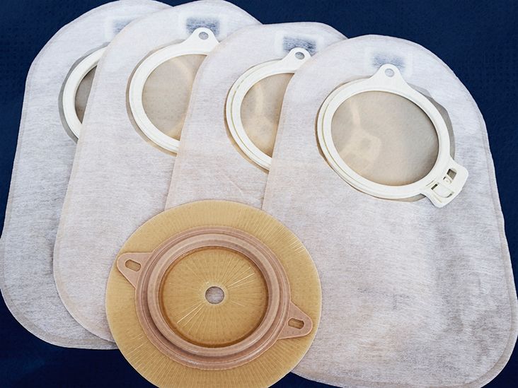 What should stool consistency be after an ileostomy?