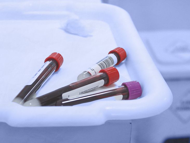 Tests for uterine cancer How it is diagnosed