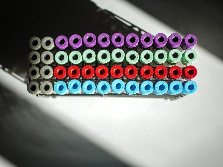 Hematocrit test What it is levels high and low range