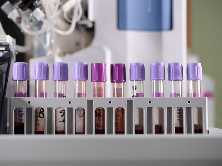 Why might a person require a blood osmolality test?