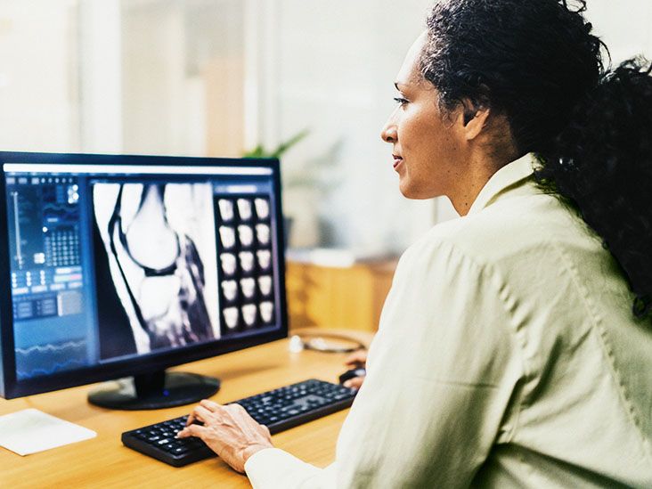 Osteochondritis dissecans radiology tests: X-ray, MRI, and more
