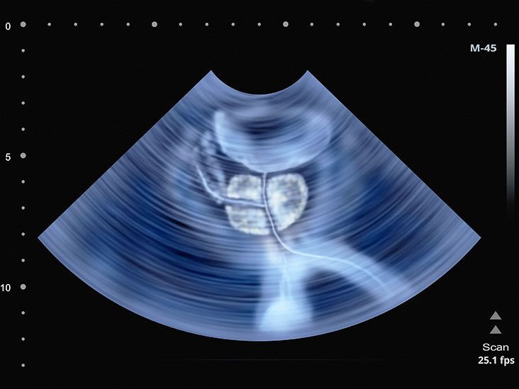 Ultrasound and non-ultrasound imaging techniques in the assessment