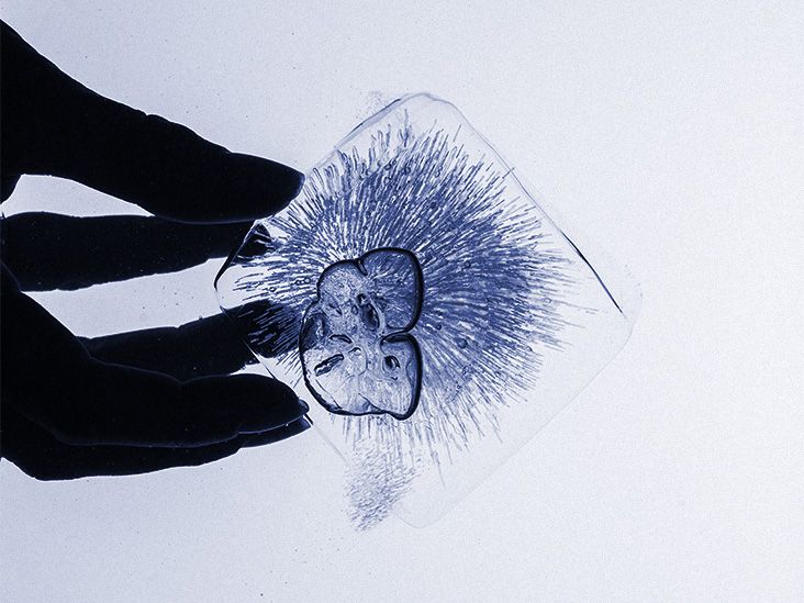 Obesity: Whole-body cryostimulation may help