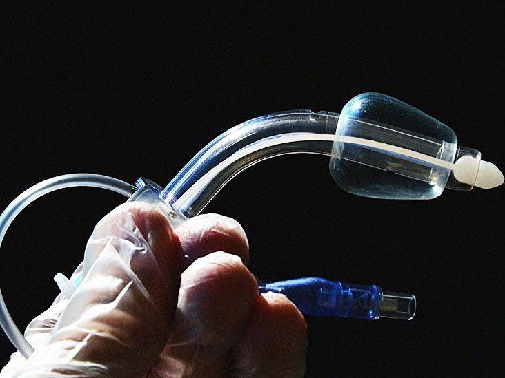 Caring for your tracheostomy A guide