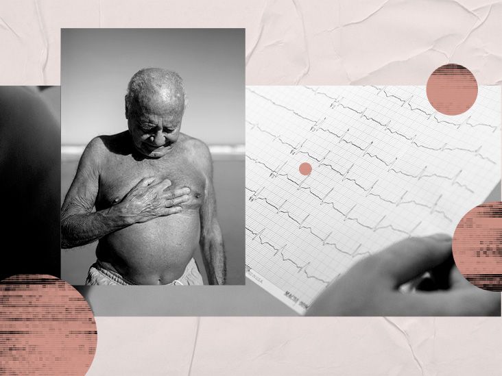 発作性心房細動の症状