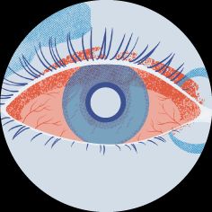 Dry Eye: A Closer Look thumbnail image