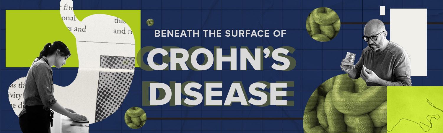 Beneath the Surface of Crohn’s Disease