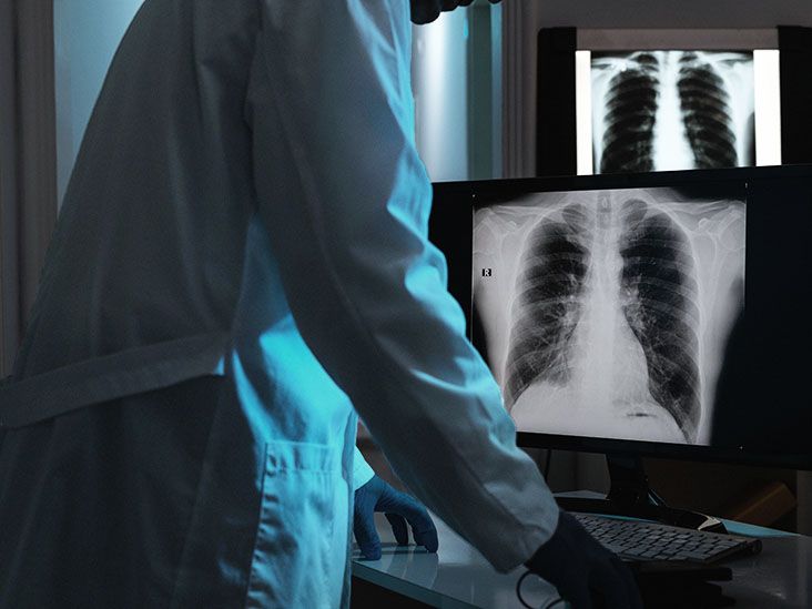 Tracheal deviation Causes, symptoms, and treatment