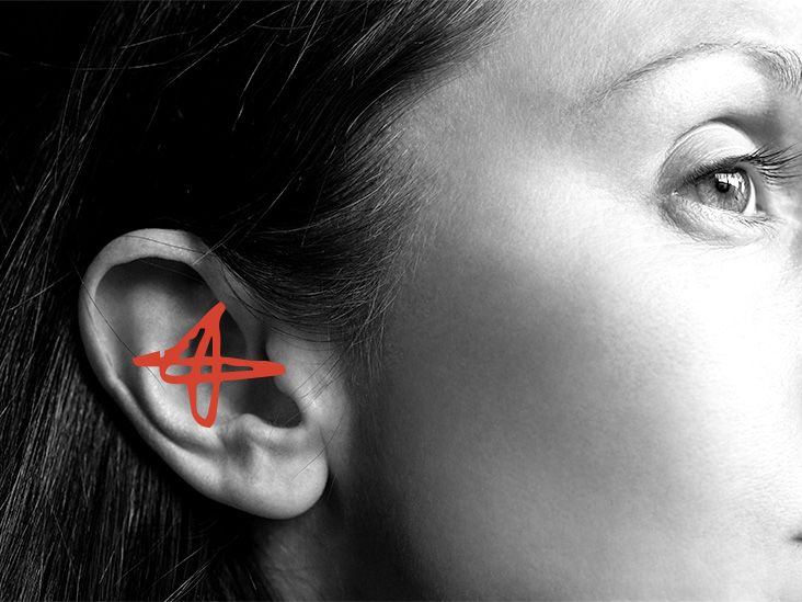 Tinnitus and deafness on sale in one ear