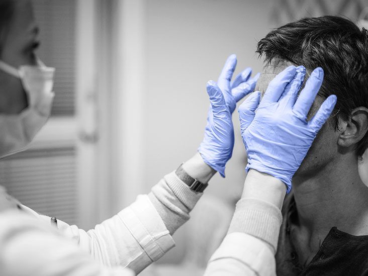 Hidradenitis suppurativa and PMOS: What is the connection?