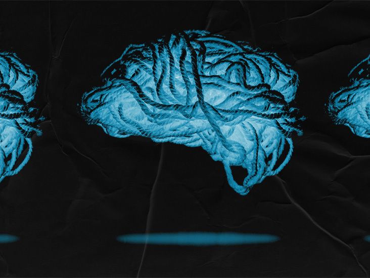 Cerebrovascular accident: Stroke types, symptoms, causes
