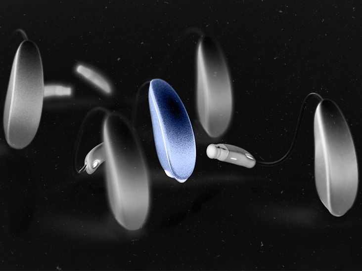 Dementia Hearing aids could reduce dementia risk by almost 50