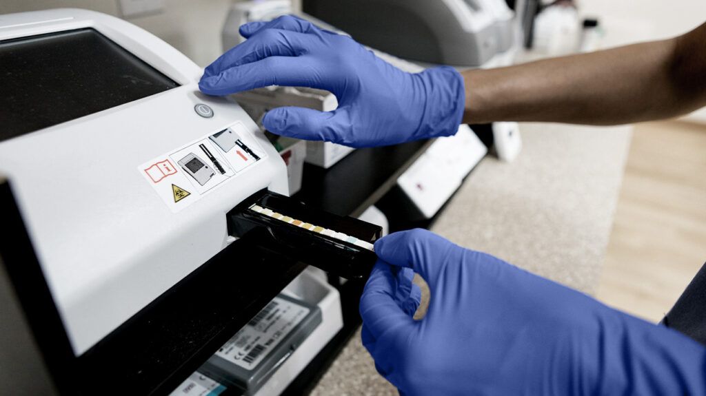 A lab worker performing a urine cytology test-1.