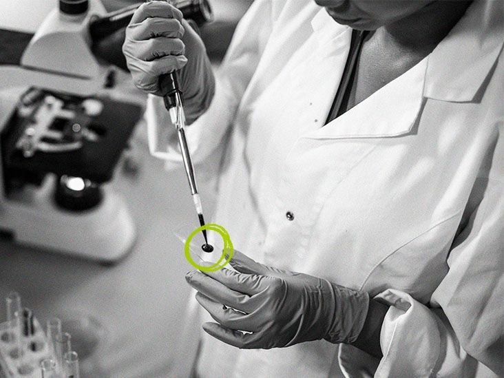 Breast cancer and CBC tests Can CBCs detect breast cancer?