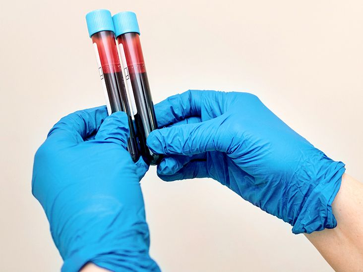 Can Covid Lower Your Red Blood Cell Count