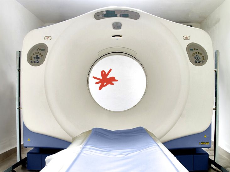 can-an-mri-detect-cancer-anywhere-in-the-body