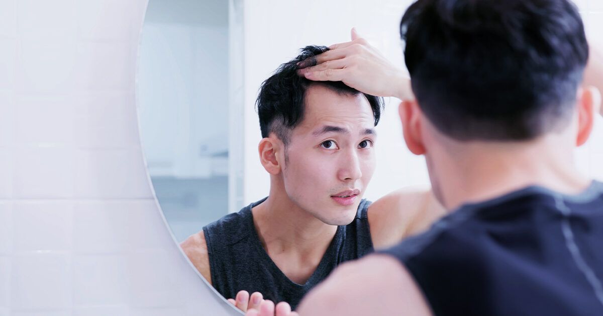Receding Hairline Stages Signs Treatment What Is An M Shaped Hairline?