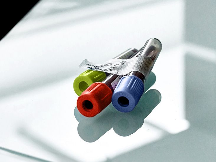 Lung cancer How a simple blood test can help detect disease earlier