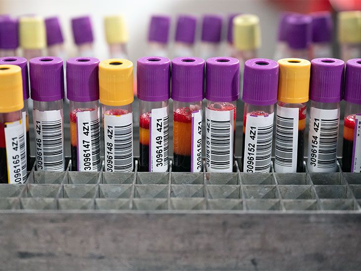 Heart health: High levels of cardiac protein may raise death risk