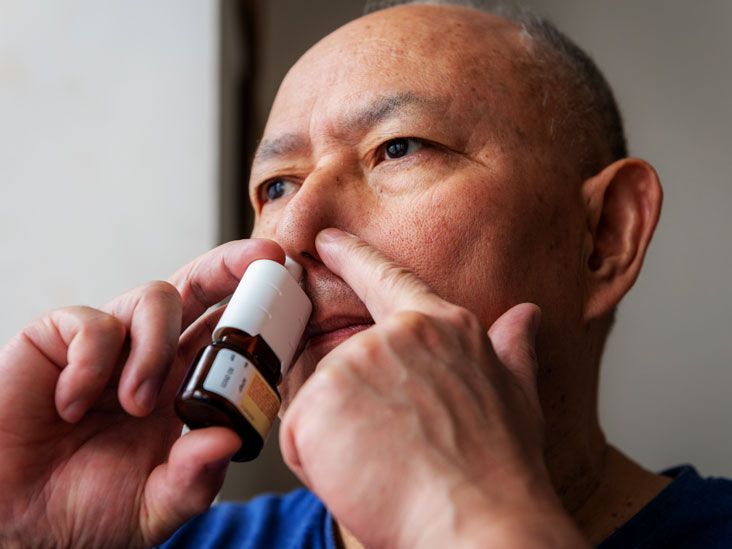 Migraine nasal spray Does it work and how to use it