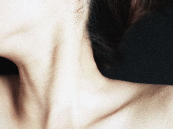 squamous-cell-carcinoma-throat-symptoms-causes-treatments