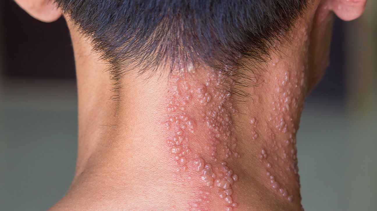 Red dots on skin: Pictures, causes, treatment, and when to seek help