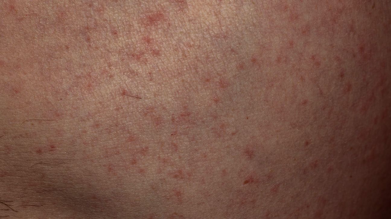 Red Spots on Skin: Causes, Treatments, and More