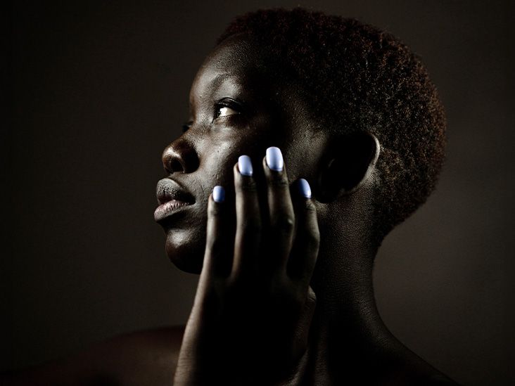 Shingles vs. eczema Similarities and differences