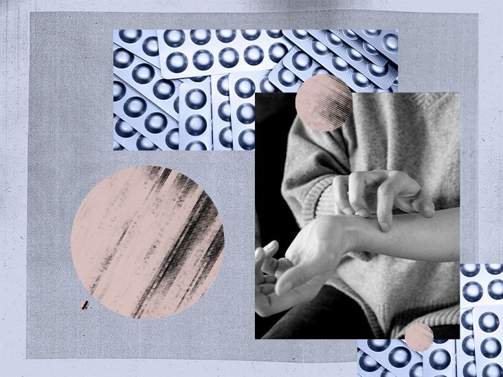 Why may antihistamines stop treating hives? Research and more