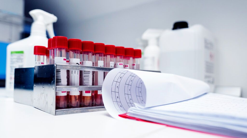 An analysis of blood to test for hepatitis C types -2.