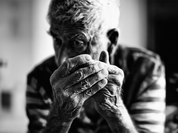 Psoriatic arthritis progression