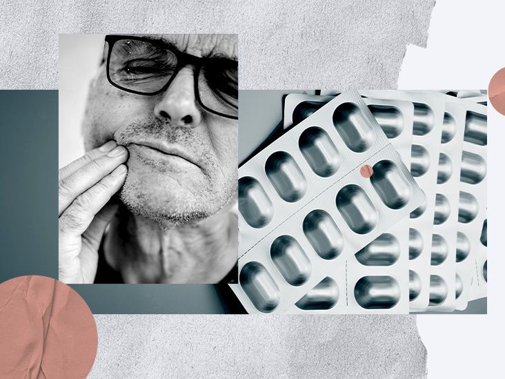 Ibuprofen ulcers Effects, symptoms, causes, and more