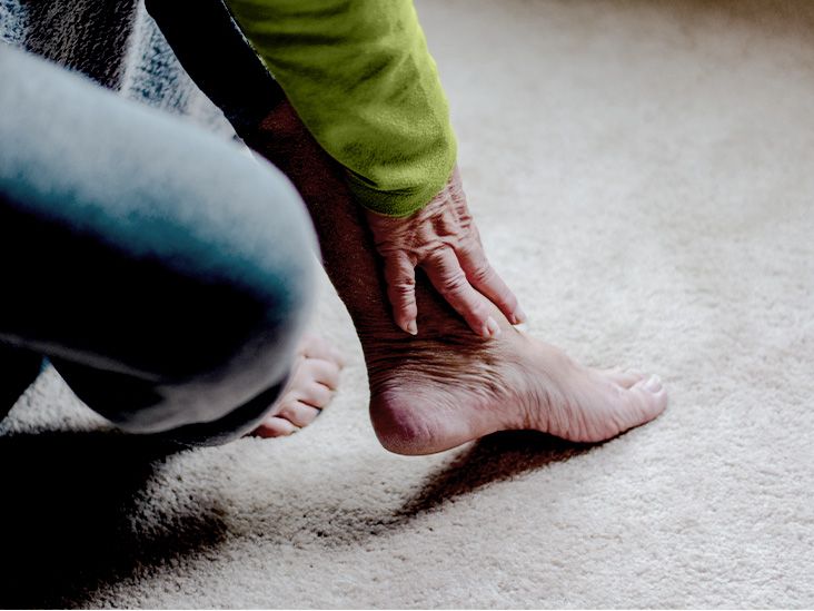 Psoriatic arthritis 14 facts