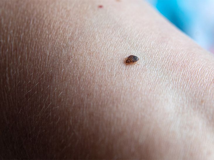Mosquito Bites on the Skin Under the Breast Stock Photo - Image of
