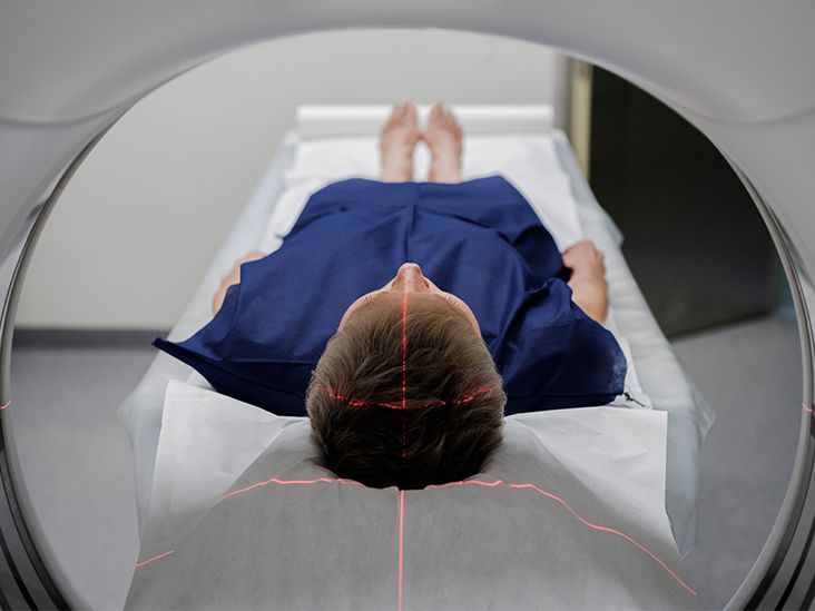 Radiologically isolated syndrome: What to know