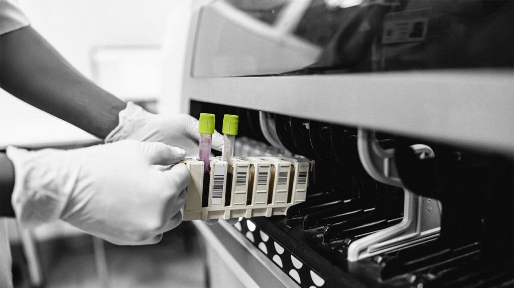 A person putting blood samples in tubes into a machine 1