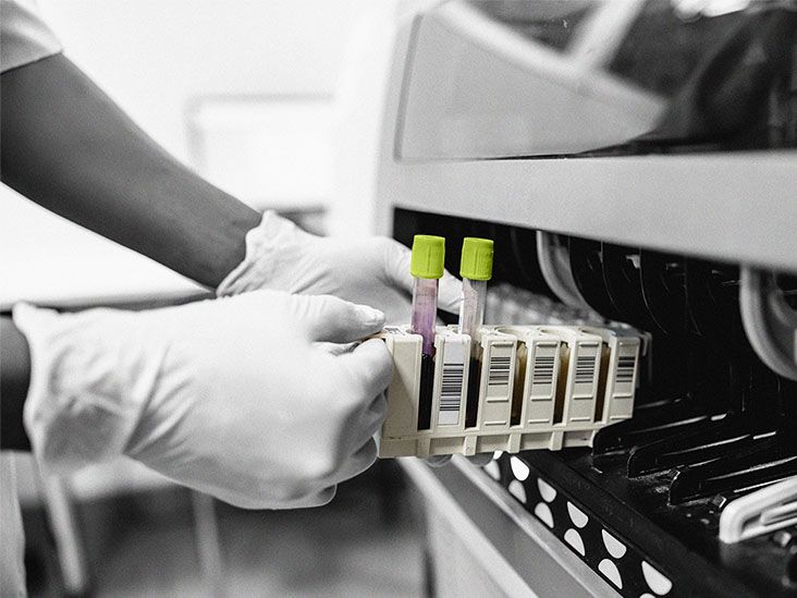 Hemochromatosis testing Physical exam, blood tests, and more