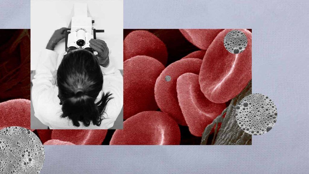 there is a collage of images of red blood cells