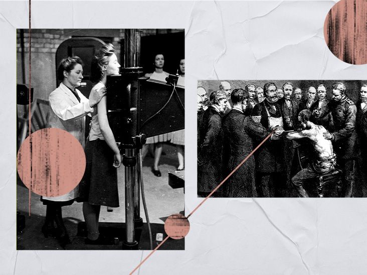 Tuberculosis history Origins, testing, treatments, and more