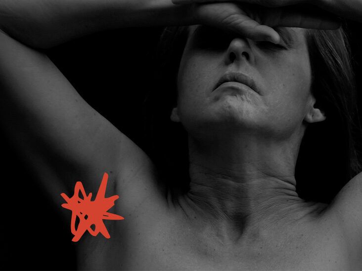 What causes an underarm rash?