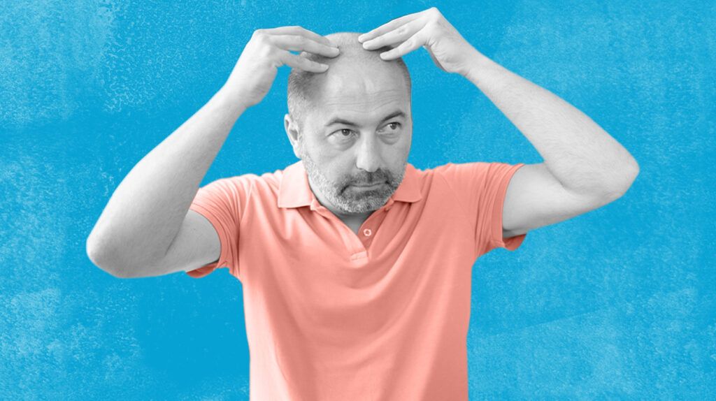 A man rubbing oil into his scalp to reduce receding hairline against a blue background.