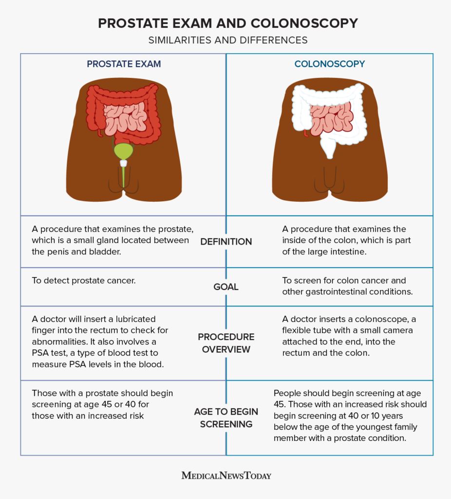 Illustration showing the difference between a prostate exam and a colonoscopy.