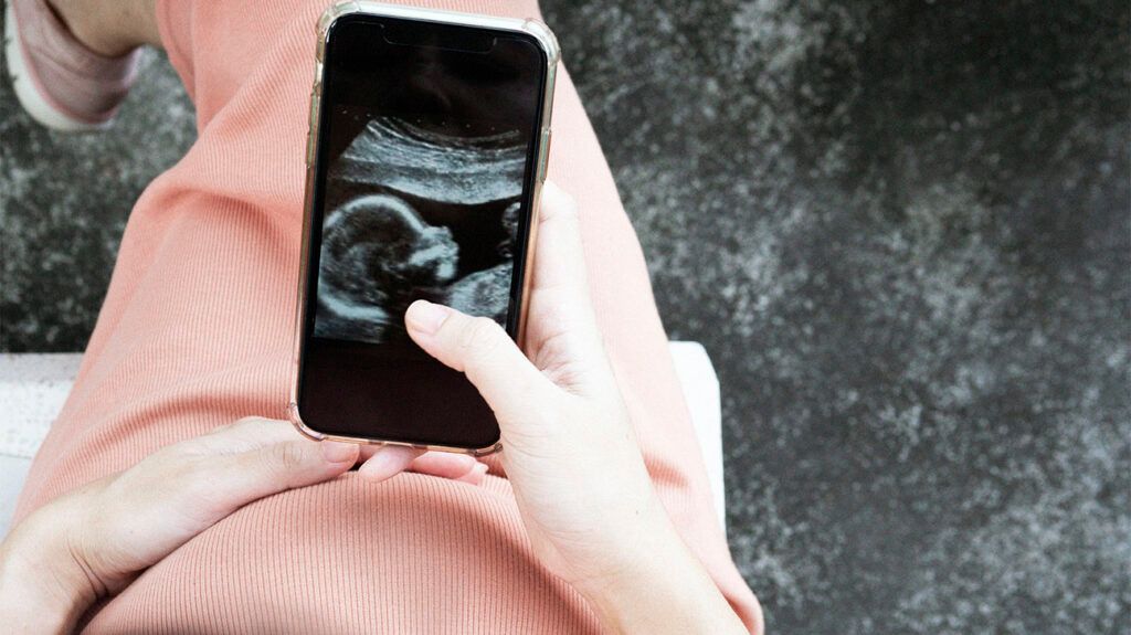 A prenatal scan of a fetus on a smartphone screen in a person's hand.