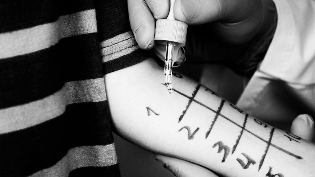 A physician performs a numbered allergy test on a child's arm